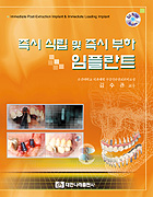 즉시 식립 및 즉시 부하 임플란트(부록 동영상 CD포함)