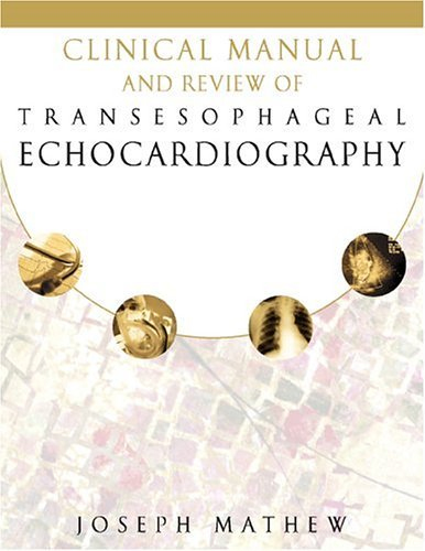 Clinical Manual and Review of Transesophageal Echocardiography