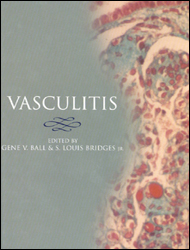 Vasculitis