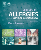 Atlas of Allergies and Clinical Immunology 3/e (Textbook with CD-ROM )