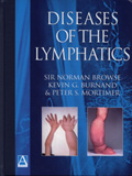 Diseases of the Lymphatics