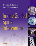 Image Guided Spine Intervention