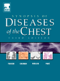 Synopsis of Diseases of the Chest-3판