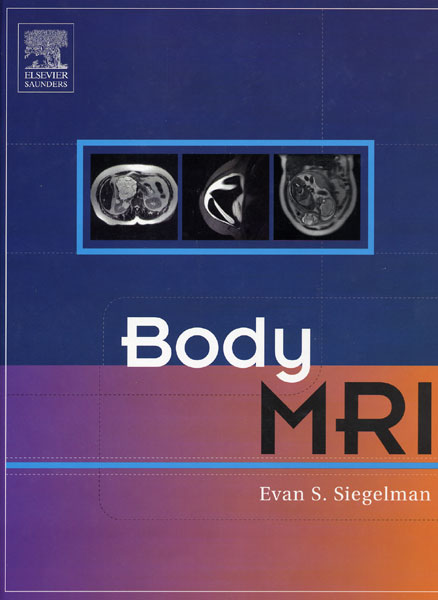 Body MRI