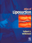 Atlas of Liposuction