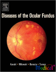 Diseases Of The Ocular Fundus