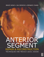 Anterior Segment Repair and Reconstruction Techniques and Medico-Legal Issues