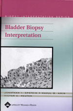 Bladder Biopsy Interpretation