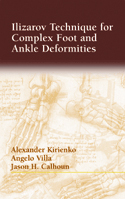 Ilizarov Technique for Complex Foot and Ankle Deformities