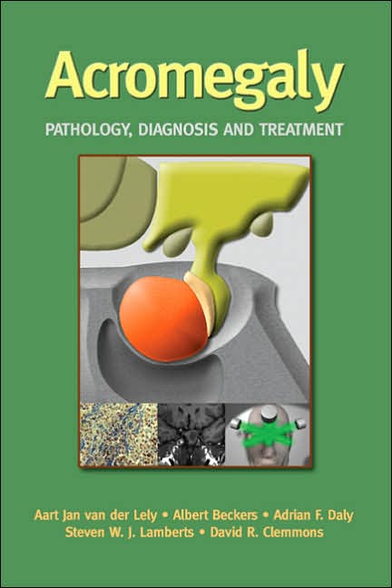 Acromegaly:Pathology Diagnosis and Treatment