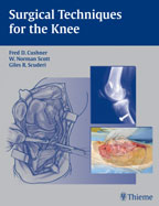 Surgical Techniques for the Knee