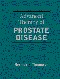 Advanced Therapy of Prostate Disease