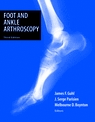 Foot and Ankle Arthroscopy