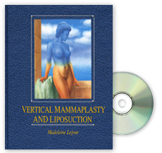 Vertical Mammaplasty and Liposuction include video tape
