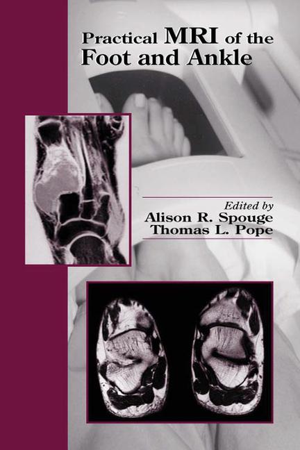 Practical MRI of the Foot and Ankle-1판