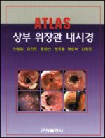 Atlas 상부 위장관 내시경