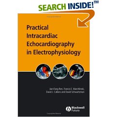 Practical Intracardiac Echocardiography in Electrophysiology