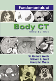 Fundamentals of Body CT  3/e