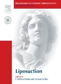 Procedures in Cosmetic Dermatology Series: Liposuction(width DVD)(pcds)