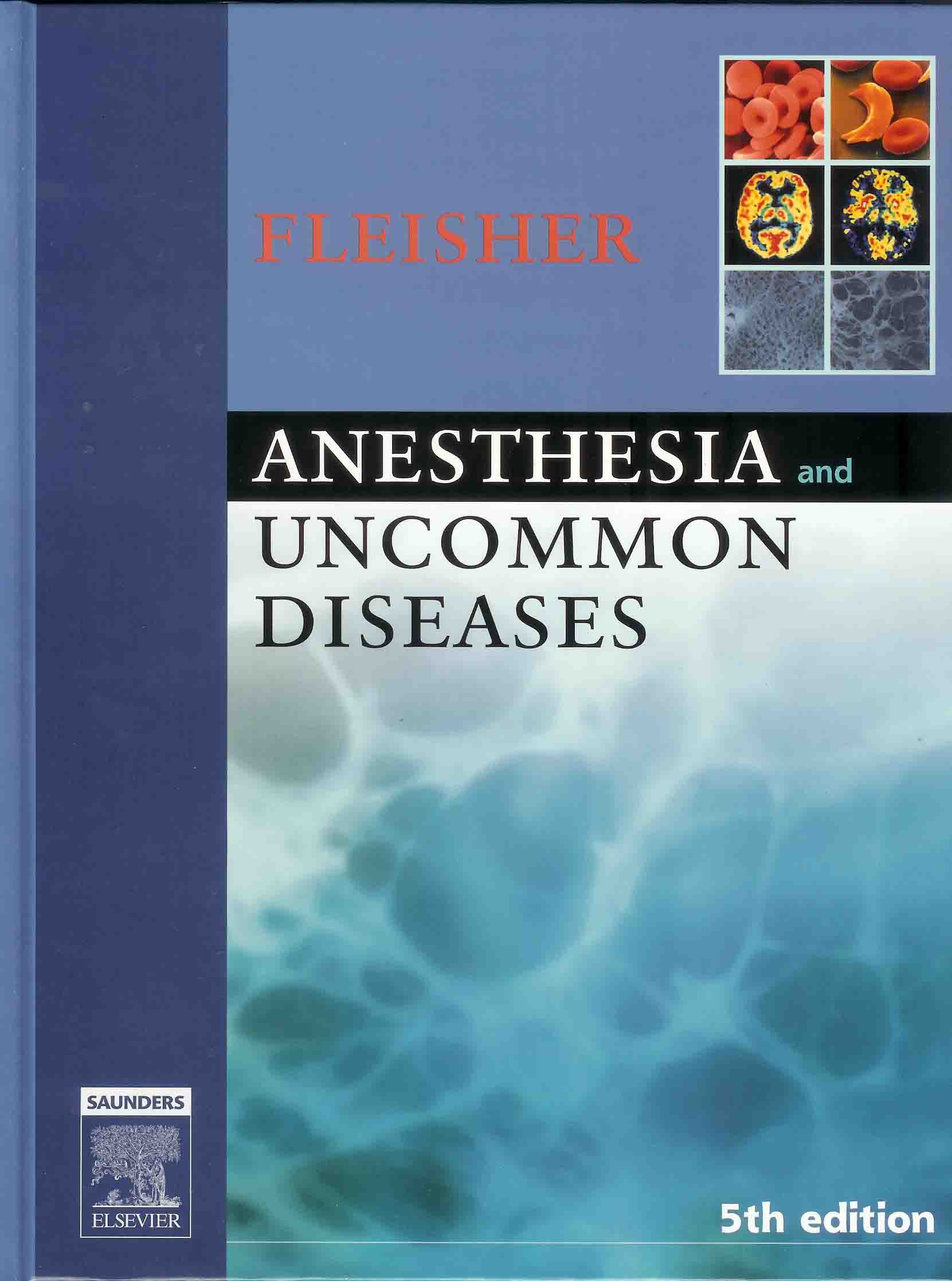 Anesthesia and Uncommon Diseases
