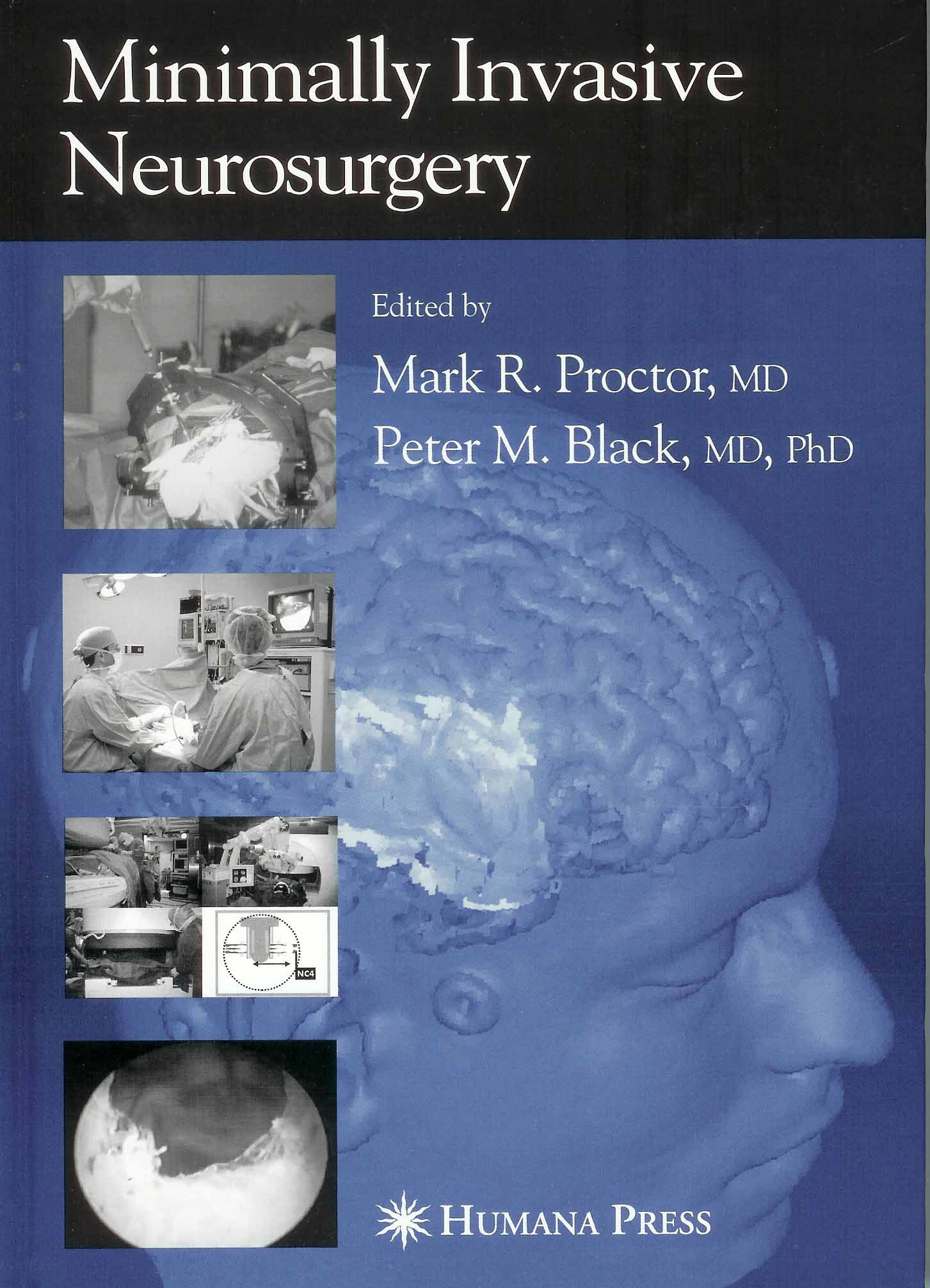 Minimally Invasive Neurosurgery
