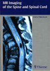 MR Imaging of the Spine and Spinal Cord