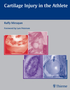 Cartilage Injury in the Athlete
