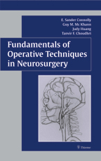 Fundamentals of Operative Techniques in Neurosurgery