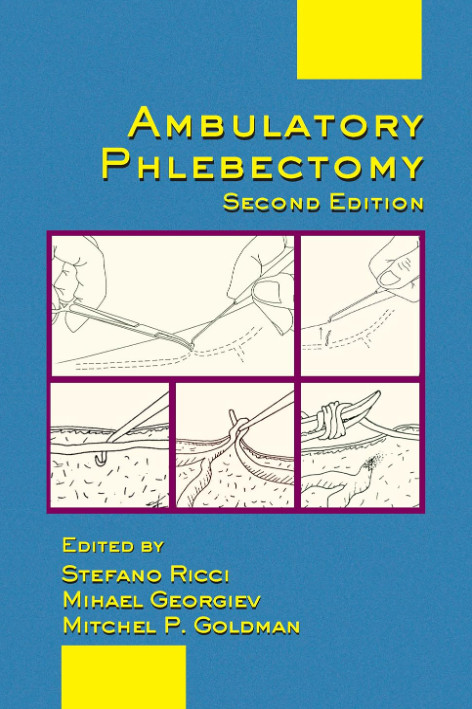Ambulatory Phlebectomy(수술동영상 포함)