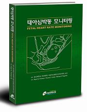 태아심박동모니터링