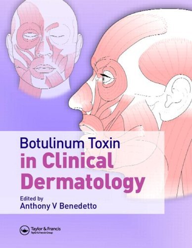 Botulinum Toxin in Clinical Dermatology