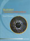Illustrated Coronary Intervention : A Case Oriented Approach