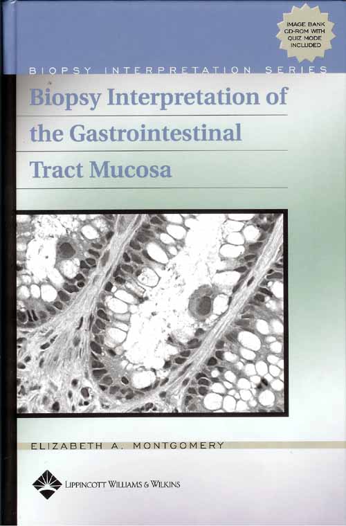 Biopsy Interpretation Of The Gastrointestinal Tract Mucosa