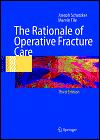 Rationale of Operative Fracture Care