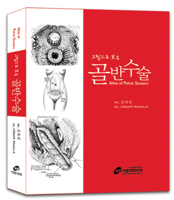 그림으로 보는 골반수술