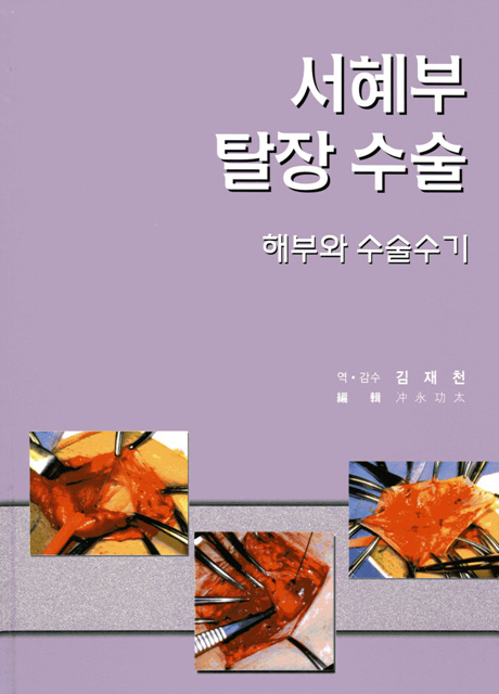 서혜부 탈장수술