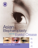 Asian Blepharoplasty and the Eyelid Crease with DVD 2/e