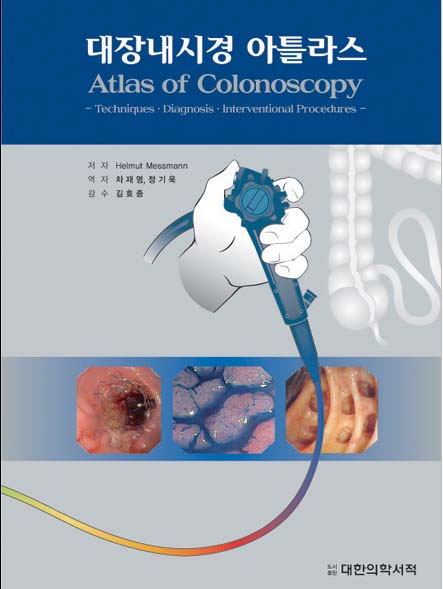 대장내시경아틀라스 - Atals of Colonoscopy