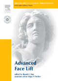 Procedures in Cosmetic Dermatology Series: Advanced Face Lifting (Textbook with DVD )(pcds)