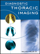 Diagnostic Thoracic Imaging 1/e