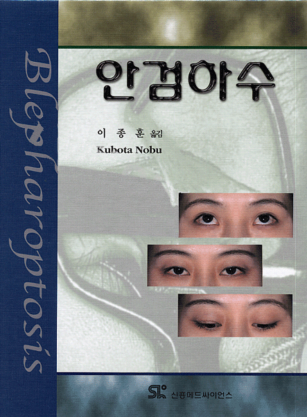 안검하수