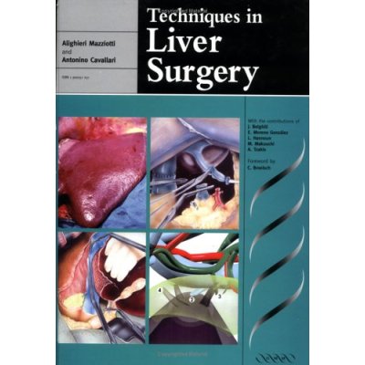 Techniques in Liver Surgery