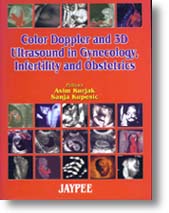 COLOUR DOPPLER AND 3D ULTRASOUND