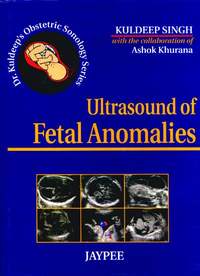 ULTRASOUND OF FETAL ANOMALIES