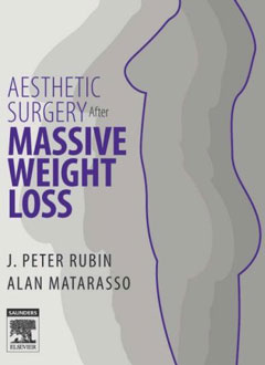 Aesthetic Surgery After Massive Weight Loss