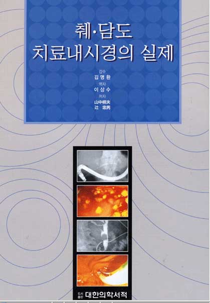 췌 담도 치료내시경의 실제