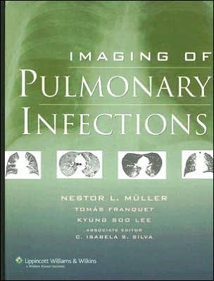 Imaging of Pulmonary Infections