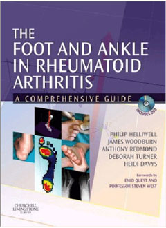 The Foot and Ankle in Rheumatoid Arthritis: A Comprehensive Guide