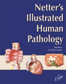 Netter's Illustrated Human Pathology