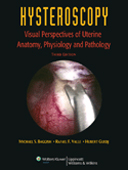 Hysteroscopy 3/e